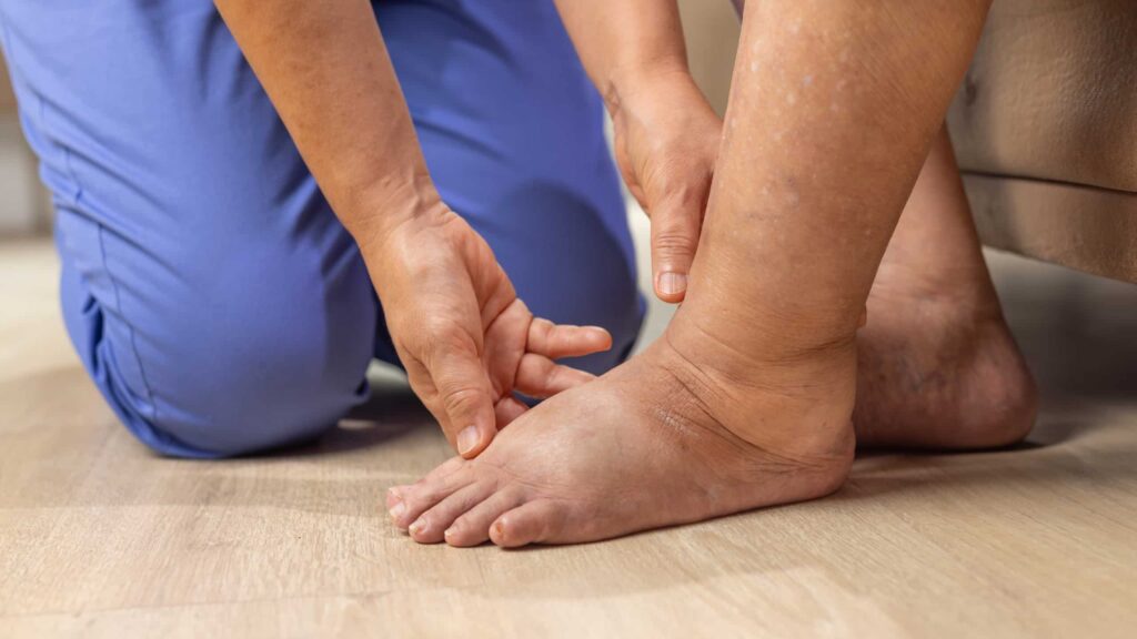 Doctor examining diabetic patient’s foot for complications.