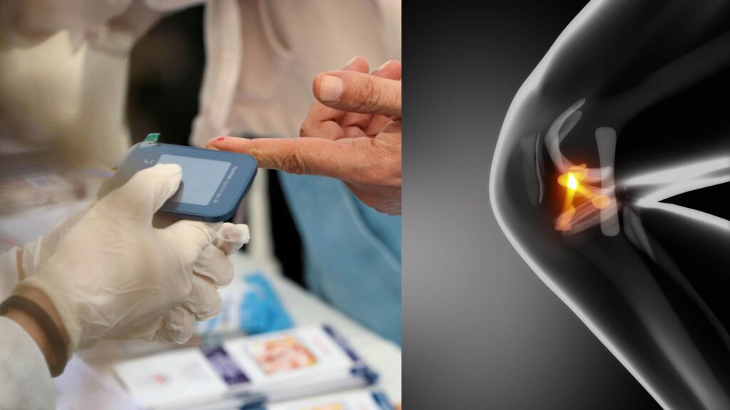 Patient doing knee rehab with diabetes management support.