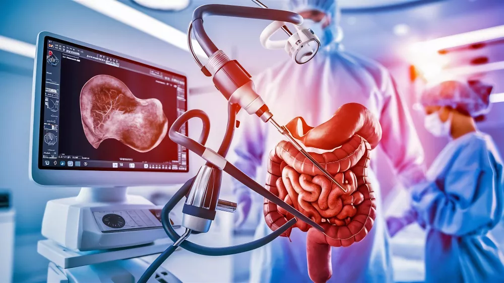 Colonoscopy